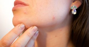 Nemoc – jaké příznaky se mohou objevovat na obličeji?